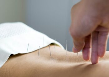 Akupunktúra na ceste k otehotneniu. Starodávna metóda s modernými dôkazmi